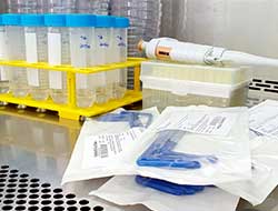 Análise microbiológica em água