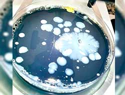 Análise Microbiológica no ABC