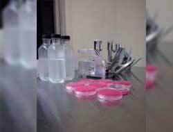 Análises Microbiológica de Água SP